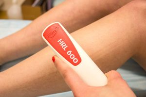 permanent hårborttagning med IPL