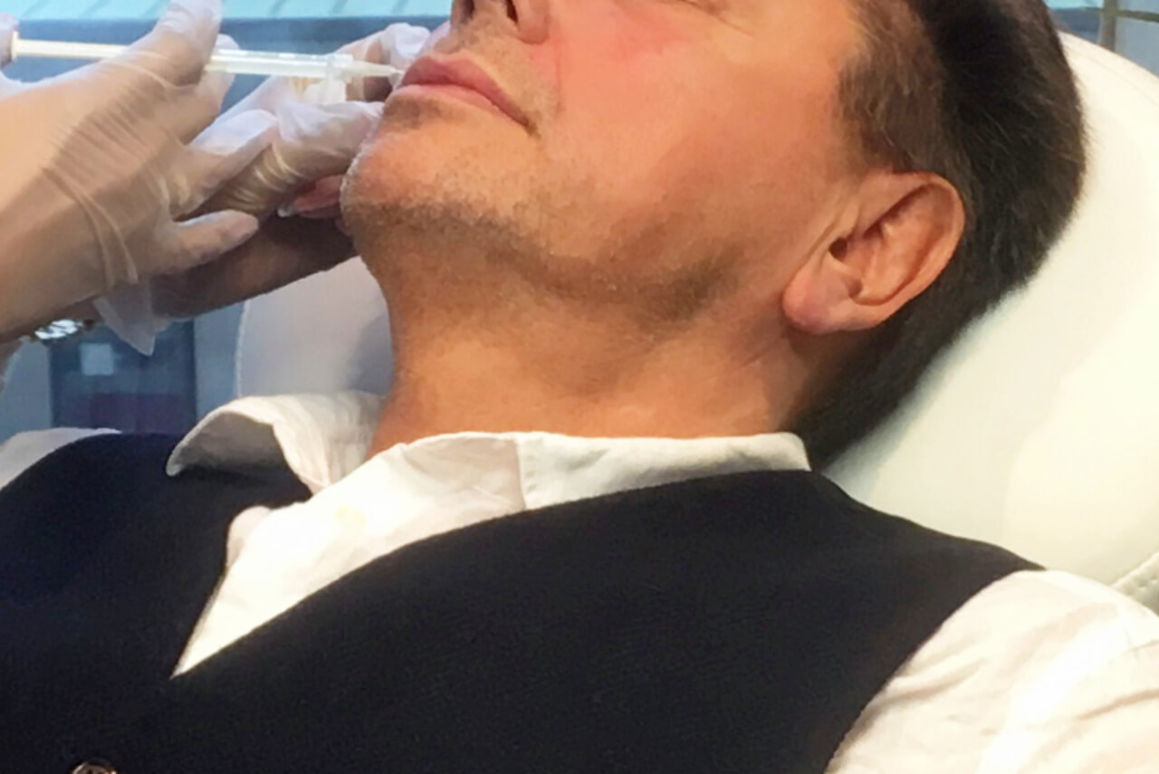 Fillers för att korrigera käklinje - Veritaskliniken