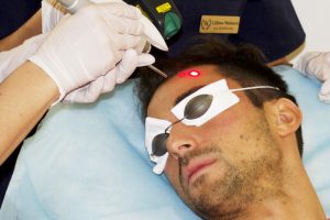 Laserpeeling - Förbättrar hudkvaliteten