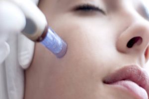 Micro Needling hos Veritaskliniken