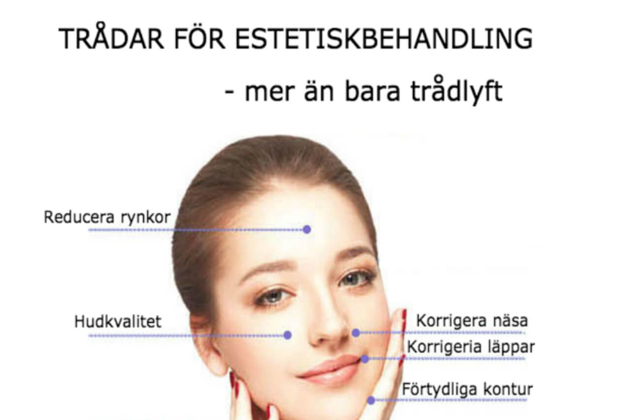 trådar för estetiskbehandling och trådlyft